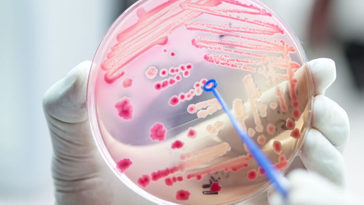Aztreonam-Avibactam bei multiresistenten Infektionen