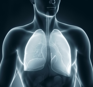 Bestimmte Genvarianten erhöhen Erkrankungsrisiko vor allem kleinerer Lungen