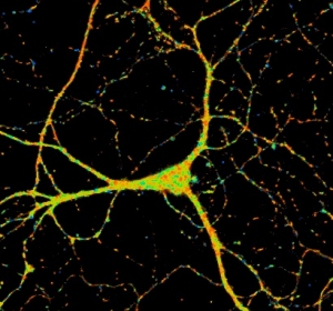 Visuelle Darstellung von Zellaktivitäten soll Alzheimer-Diagnose erleichtern