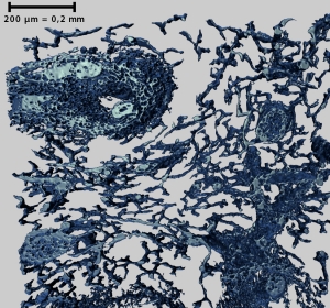 3D-Bilder vom Netzwerk kleinster Blutgefäße