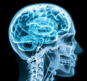 Huntington-Krankheit: Neurologische Leitlinie bewertet neue Therapieansätze