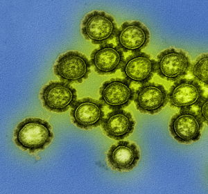 Erste Verteidigungslinie gegen Grippe weiter entschlüsselt