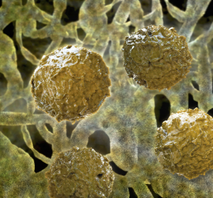 Osteopetrose-Behandlung: Mit Stammzellen besiedelte Trägerstrukturen führen zu vielversprechenden Ergebnissen