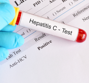 Screening auf Hepatitis B und Hepatitis C: Nutzen mangels geeigneter Studien unklar