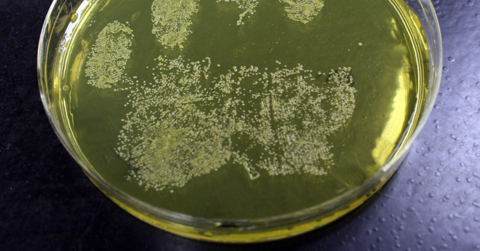 Staphylococcus aureus: Bakteriengifte lösen wichtige Bremse des Immunsystems