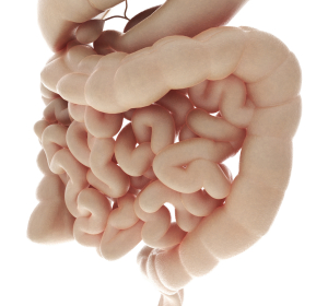 Seltene Erkrankung: abdominelle Beschwerden und rezidivierende Hautschwellungen deuten auf hereditäres Angioödem hin