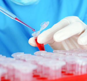 Tier-Blutproben könnten Aufschluss über Krankheitsgenese beim Menschen geben