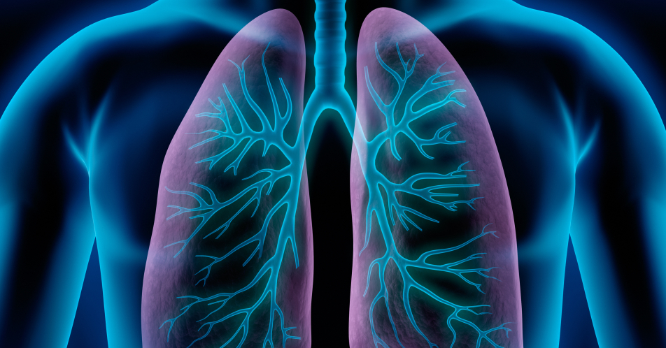 COPD: Entblähung der Lunge durch effektive Bronchodilatation