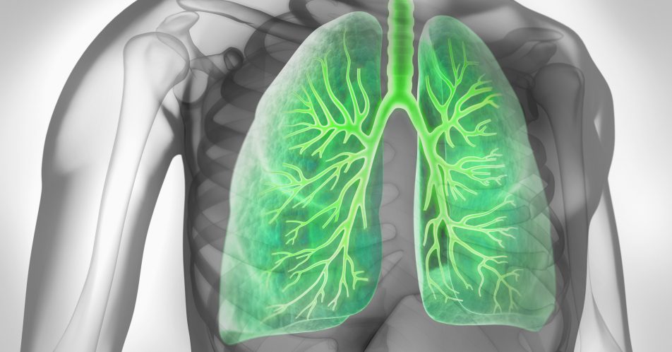 COPD: Eine neue Dreifach-Kombination bei Atemnot?