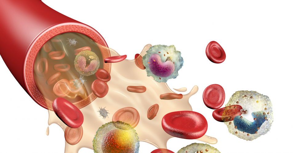 ASCVD: Signifikante Senkung des LDL-Cholesterin unter Bempedoinsäure