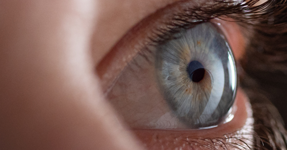 Fuchs'sche Hornhaut-Dystrophie: Gewebetransplantation ermöglicht erneutes Sehvermögen