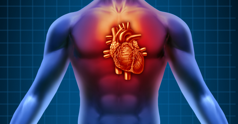 Herzmuskelentzündung: Impella-Pumpe als dauerhaftes Implantat
