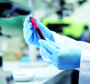 AOK will Erstattung für PCR-Test auf 15 Euro drücken 