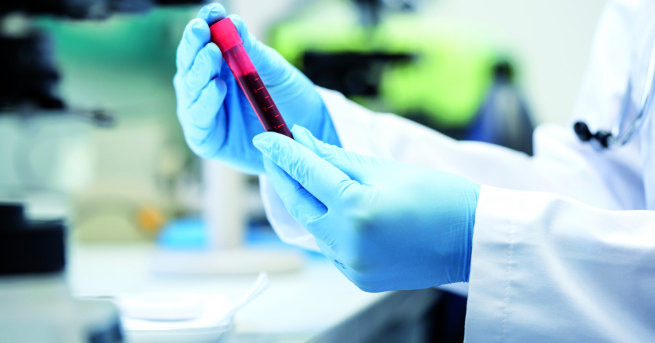 AOK will Erstattung für PCR-Test auf 15 Euro drücken 