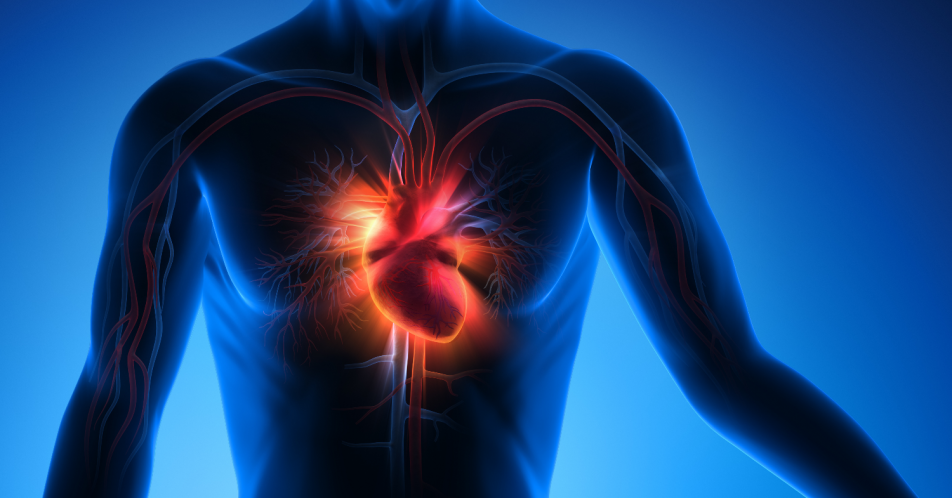 Rheuma: Erhöhtes kardiovaskuläres Risiko