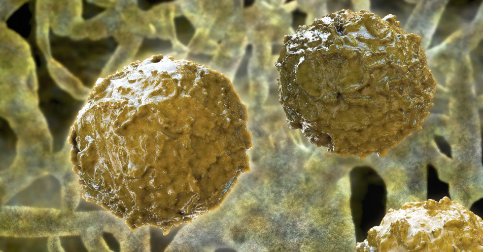 Adenovirus-Infektion nach Stammzelltransplantation: Arsentrioxid stärkt körpereigene Abwehr