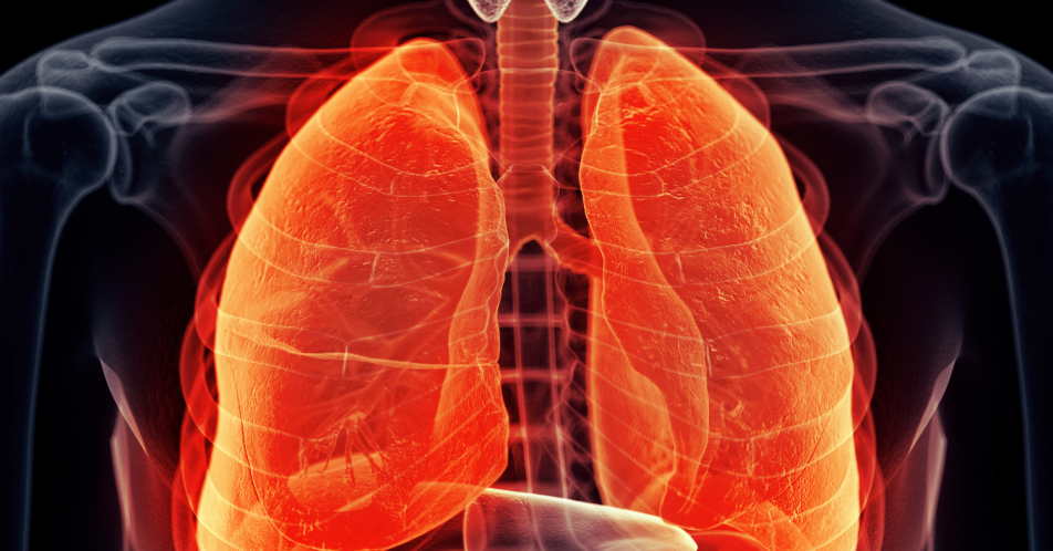 COPD: Zulassungsempfehlung für Triple-Kombination