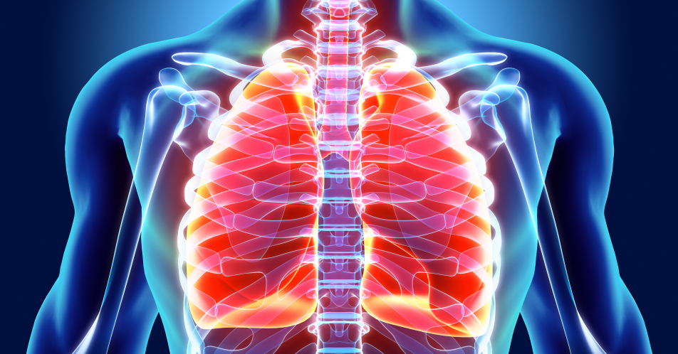 Chronische progredient fibrosierende interstitielle Lungenerkrankungen: G-BA bestätigt Zusatznutzen von Nintedanib