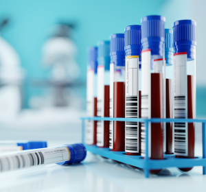 NIPT-Bluttest: Neue Beratungen des Bundestages zu den Bedingungen der Kassenfinanzierung gefordert