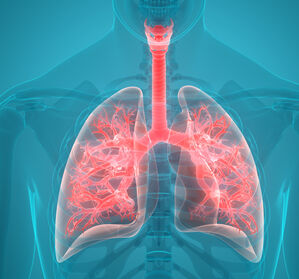 Lungenembolie: Einsatz des Endovascular System + Antikoagulation