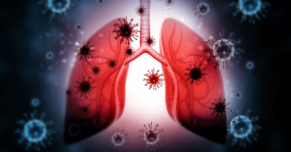 COVID-19: Klinische Studie mit inhalativem APN01