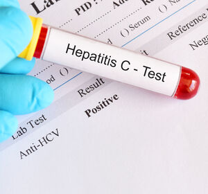 Virushepatitiden: Das Management von Hepatitis C und D optimieren
