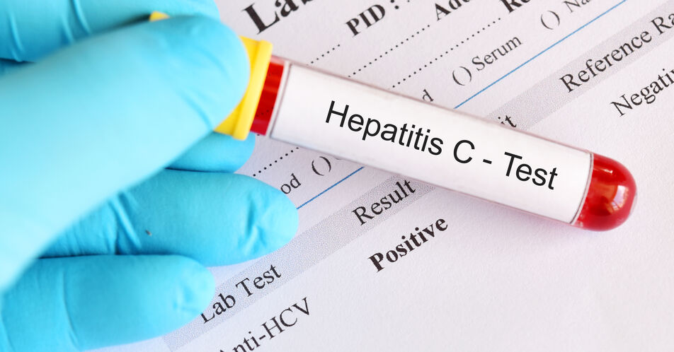 Virushepatitiden: Das Management von Hepatitis C und D optimieren