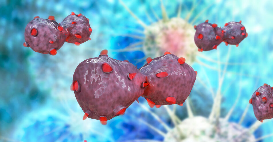 HIV und Krebs: Früher Beginn antiretroviraler Therapie senkt Risiko