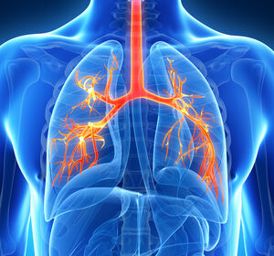 Lungenfibrose nach COVID-19 trotz dafür untypischem Krankheitsverlauf