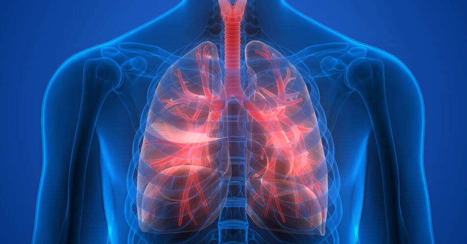 COPD: Wann sollte die Triple-Therapie beginnen?