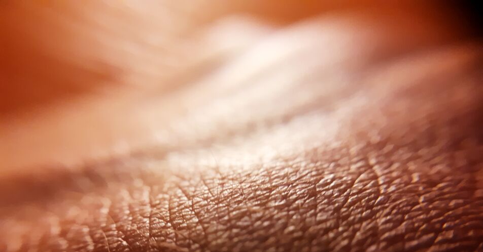 Atopische Dermatitis: MEASURE-AD-Studie zeigt hohen Therapiebedarf