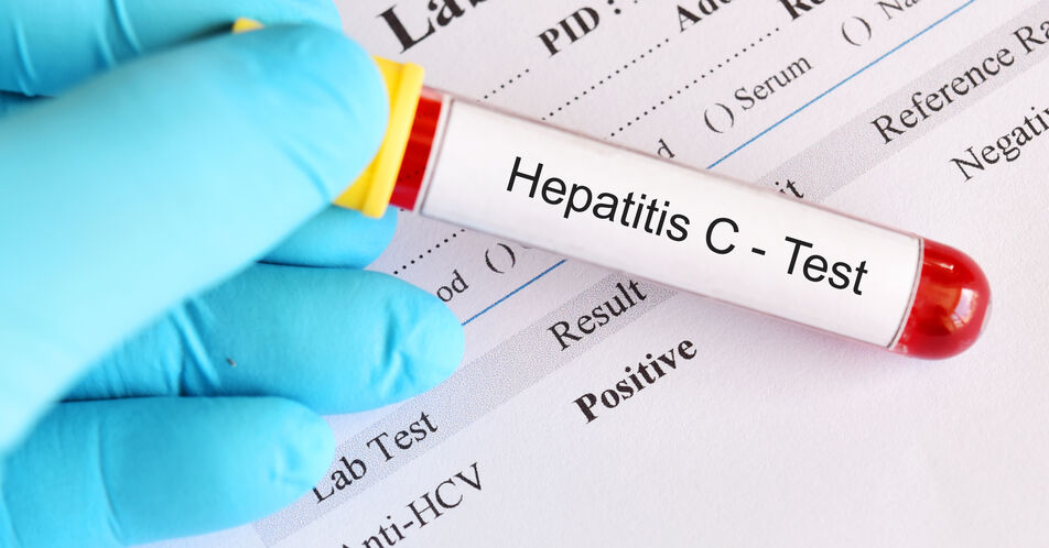HCV: Aktueller Stand der Diagnostik und Therapie