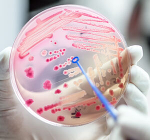 Diagnostischer Test zur Unterscheidung zwischen bakteriellen und viralen Infektionen