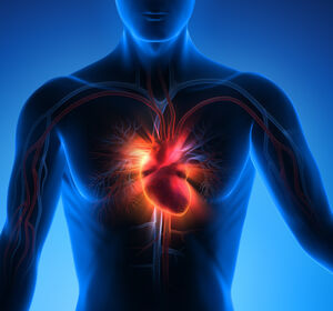 Ablation bei Vorhofflimmern: Verringert zu viel Herzfettgewebe den Therapieerfolg?