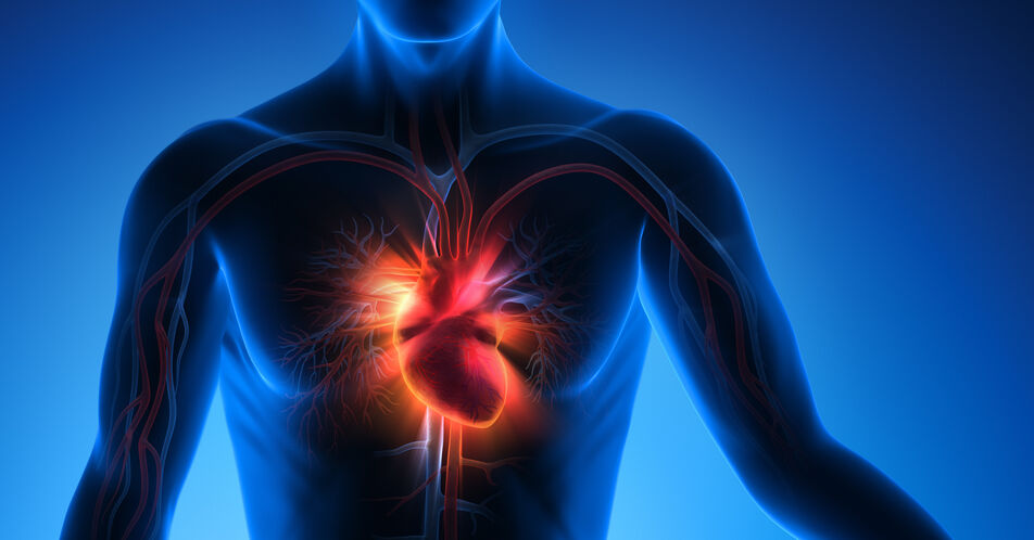 Ablation bei Vorhofflimmern: Verringert zu viel Herzfettgewebe den Therapieerfolg?