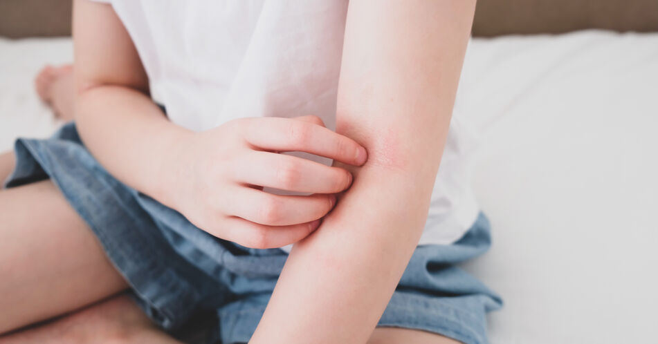 Update atopische Dermatitis: Tipps für die Therapie im Kleinkindes- und Kindesalter