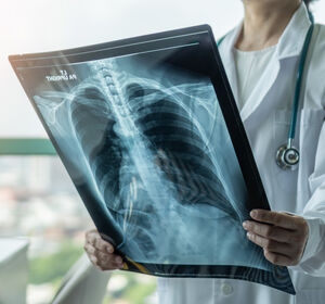 DGP 2023: „Inhalative COPD-Therapien – viele Beweise und (k)eine Frage(n)“