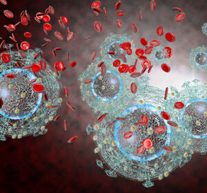 Viruslast unter die Nachweisgrenze senken – auch bei HIV-Betroffenen mit HBV/HDV