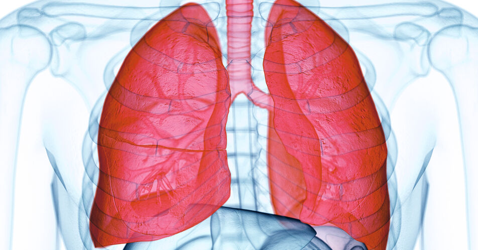 Schweres eosinophiles Asthma: Remission unter Benralizumab
