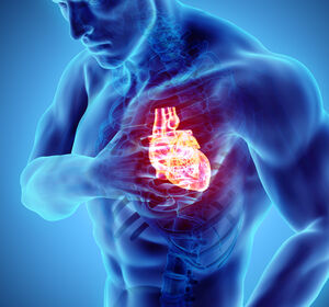 Weniger Herzinfarkte: Kombinationstherapie mit Alirocumab zur LDL-C-Senkung