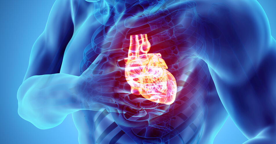Weniger Herzinfarkte: Kombinationstherapie mit Alirocumab zur LDL-C-Senkung