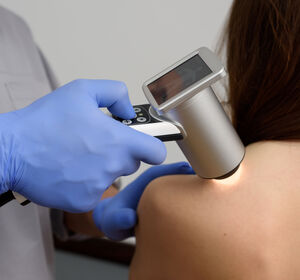Hautärzte-Verband fordert staatlich organisiertes Hautkrebs-Screening