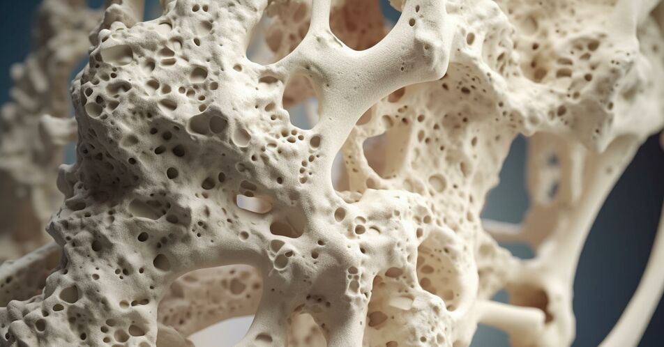 Osteoporose: Teriparatid als Fertigpen ab sofort verfügbar