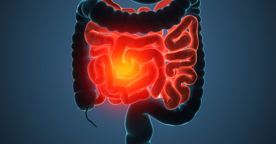 MSOT – Weiterentwicklung des Ultraschalls lokalisiert Entzündung bei Morbus Crohn