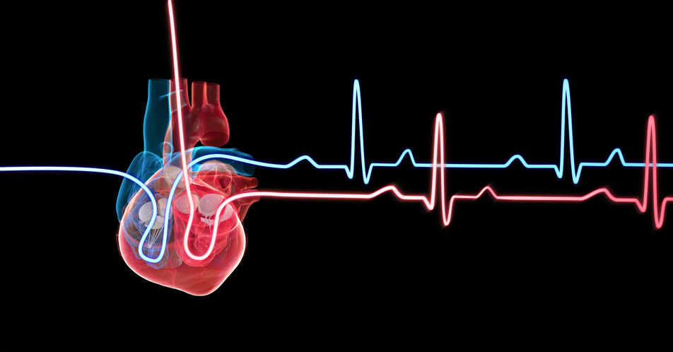 Patientennahe NT-proBNP-Testung als zuverlässiges Warnsystem für die Herzinsuffizienz
