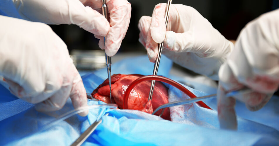 Herzoperation bei Kindern mit Ein-Kammer-Herz: Wie wirkt sich die OP im Erwachsenenalter aus?