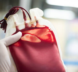 Künstliche Intelligenz macht den Bedarf an Blutprodukten besser planbar