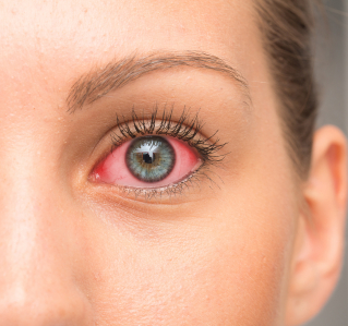 Neue Studie von Lenstore deckt auf, wie man die Welt mit den geläufigsten Augenerkrankungen sieht