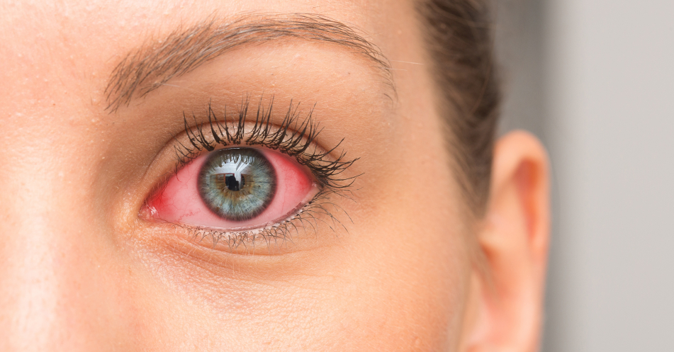 Neue Studie von Lenstore deckt auf, wie man die Welt mit den geläufigsten Augenerkrankungen sieht