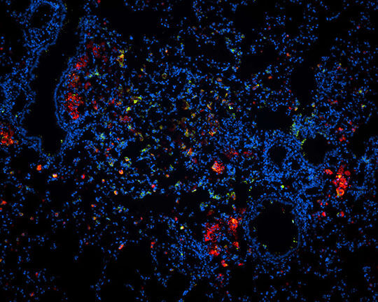 Abb. Die Mikroskopaufnahme eines Lungenschnittes einer mit TB infizierten Maus zeigt in Rot die Wirkstoff-Nanopartikel © FZB Zelluläre Mikrobiologie, Dr. N. Redinger